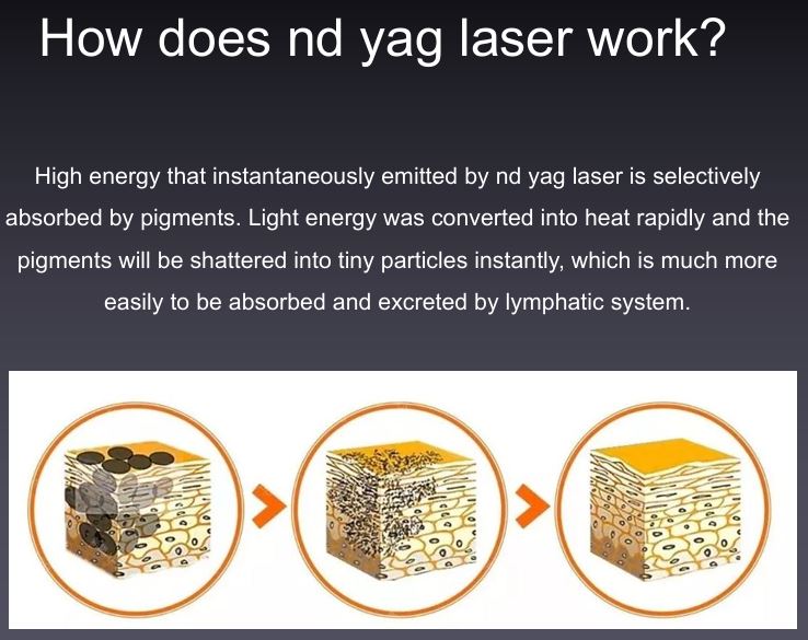 yagd work
